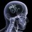 Ver manual de ¿Qué es la migraña?